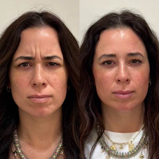 Before and after showing people making various expressions 6