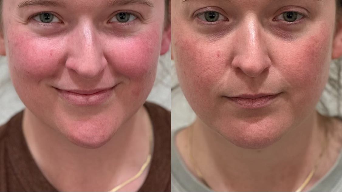 Expert injector team, professional and confident