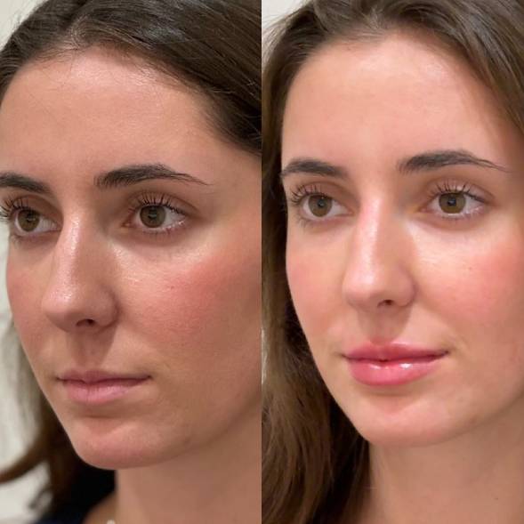 Close-up of woman's natural, subtly enhanced lips with soft smile, natural lighting