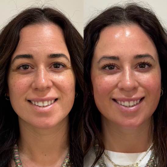 Woman with smooth forehead making natural expression, smiling genuinely