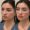 Before and after results of a female patient who received cheek and lip dermal fillers at Austin Aesthetic Atelier, showcasing enhanced volume and definition.