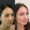 Before and after photo of a female patient treated with dermal fillers at Austin Aesthetic Atelier, highlighting improved cheek volume and smoother smile lines.