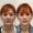 Before and after image of a female patient who received under-eye and midface dermal filler at Austin Aesthetic Atelier, showing brighter eyes and improved facial volume.